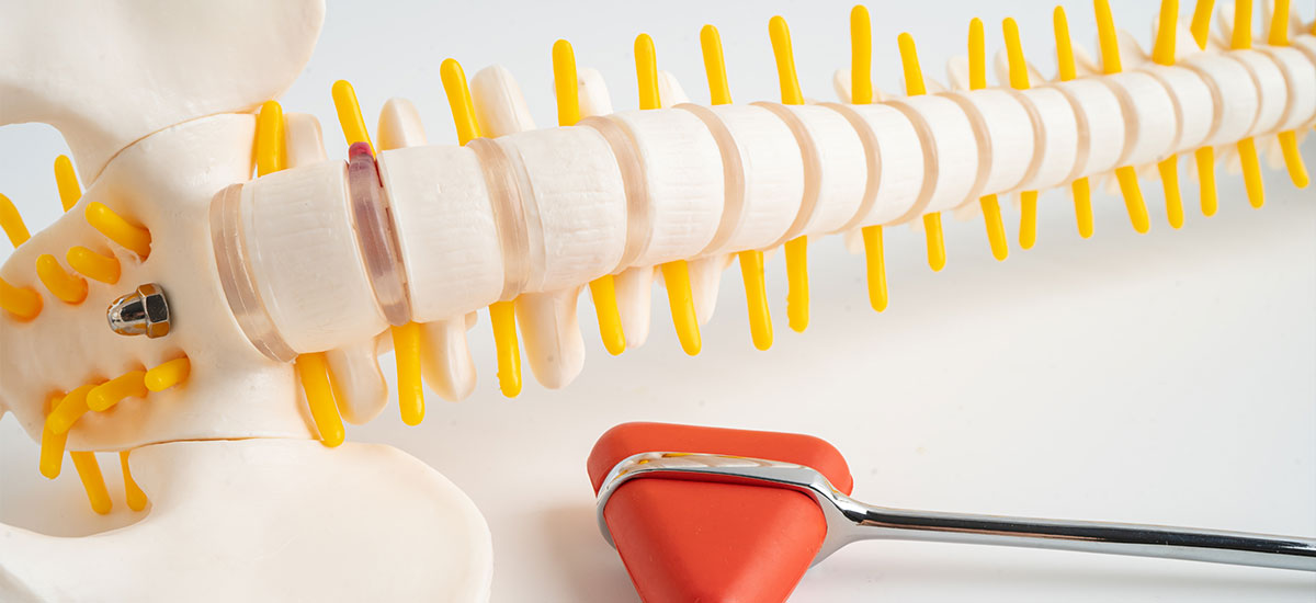 Comprehensive Care for Disc Issues at Beacon of Life Chiropractic