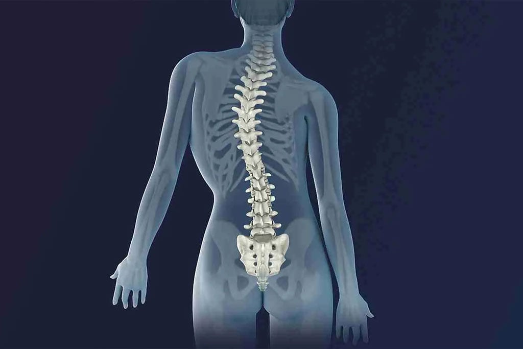 Scoliosis Treatment at Active Chiropractic at Royersford, PA Scoliosis Treatment at Active Chiropractic at Royersford, PA